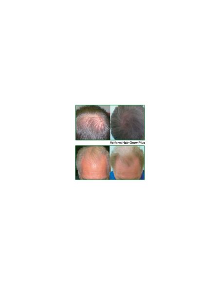 Лазерна четка за коса Power Grow Comb
