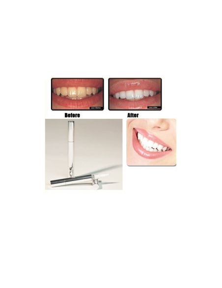 Teeth Whitening Pen Избелваща писалка за зъби